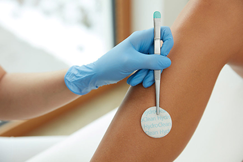 癌症腫瘤傷口照護