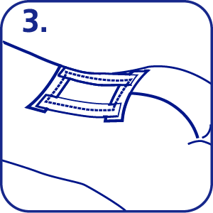 如何使用Ag 赫曼含銀軟膏敷料