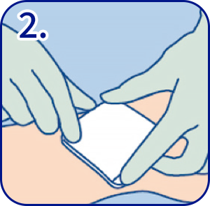 如何使用HydroClean 赫曼傷口敷料墊